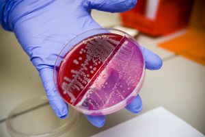 Gloved hand holding a petridish