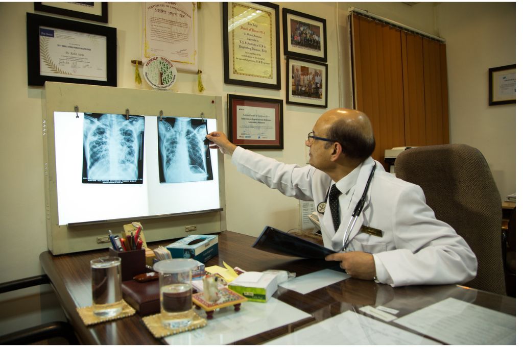 a doctor examining chest x-rays - tuberculosis